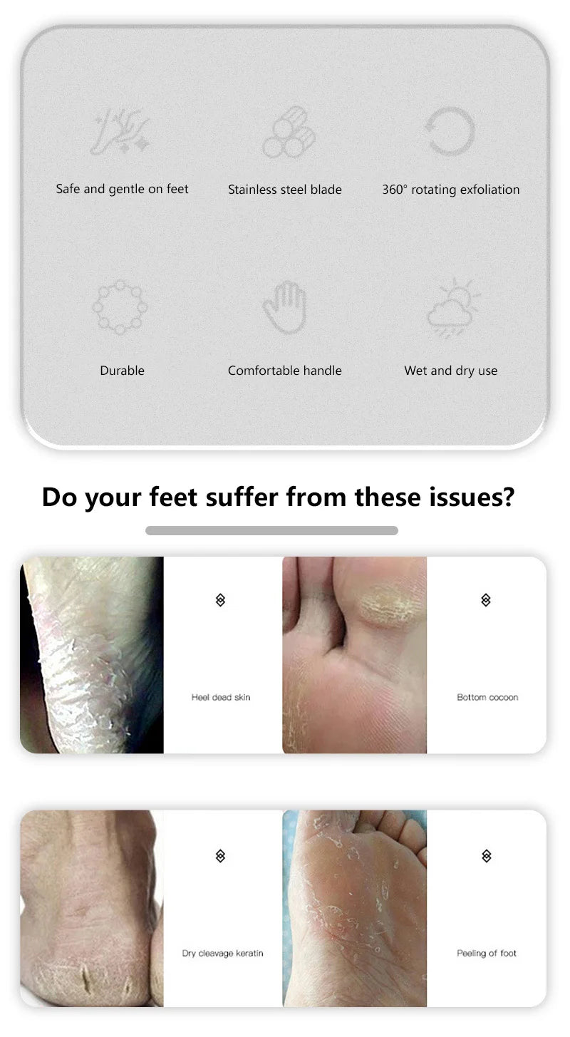Professional Stainless Steel Foot File for Cracked Heels and Calluses - 9