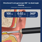 HD WiFi Visible Ear Wax Removal Tool
