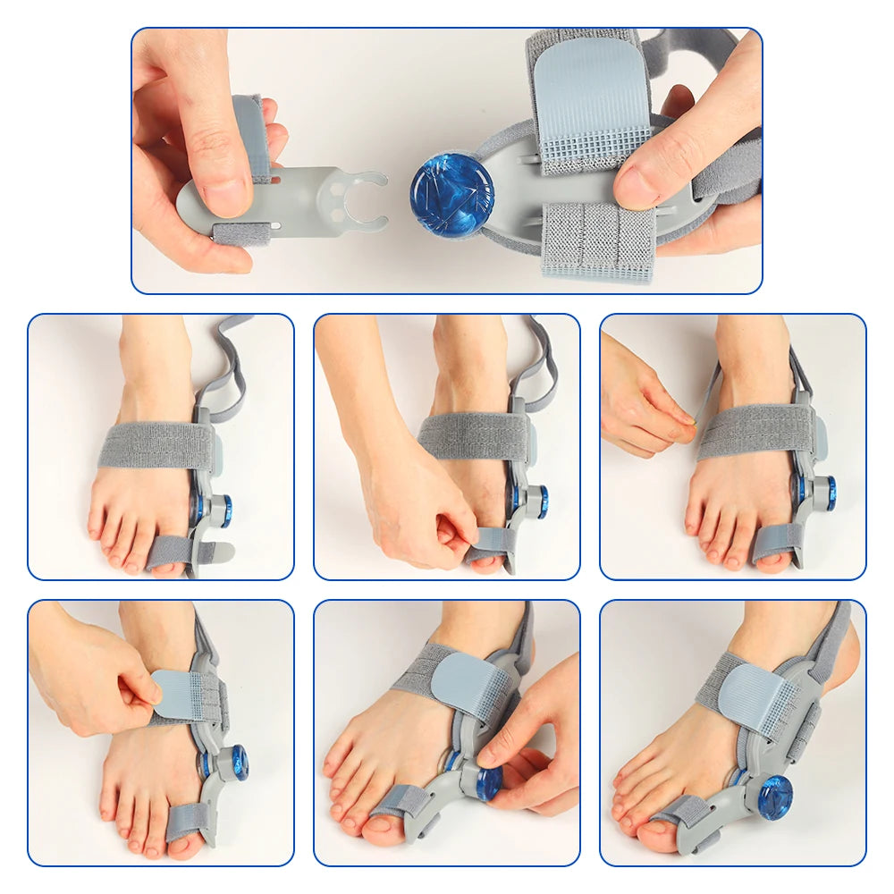 Adjustable Bunion Corrector and Toe Straightener