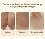 Electric Rechargeable Foot Callus Remover for Pedicure