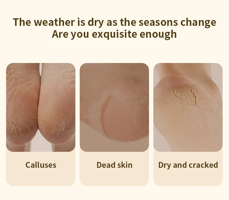 Electric Rechargeable Foot Callus Remover for Pedicure