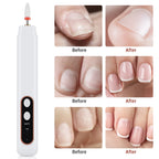 Electric Manicure and Pedicure Nail Drill File Kit