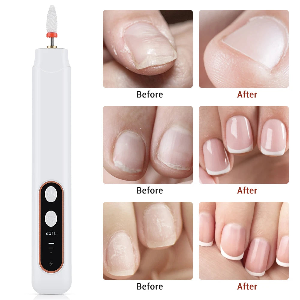 Electric Manicure and Pedicure Nail Drill File Kit