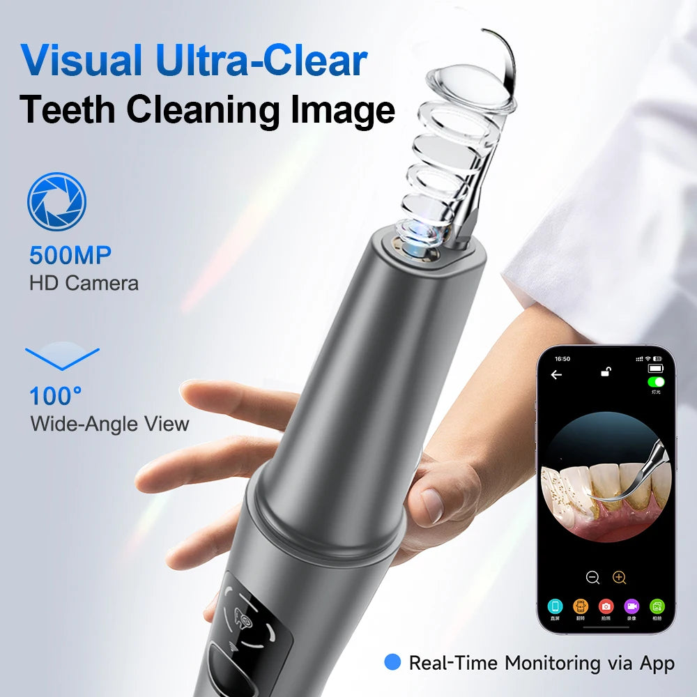Visual Ultrasonic Dental Scaler with HD Camera - 2