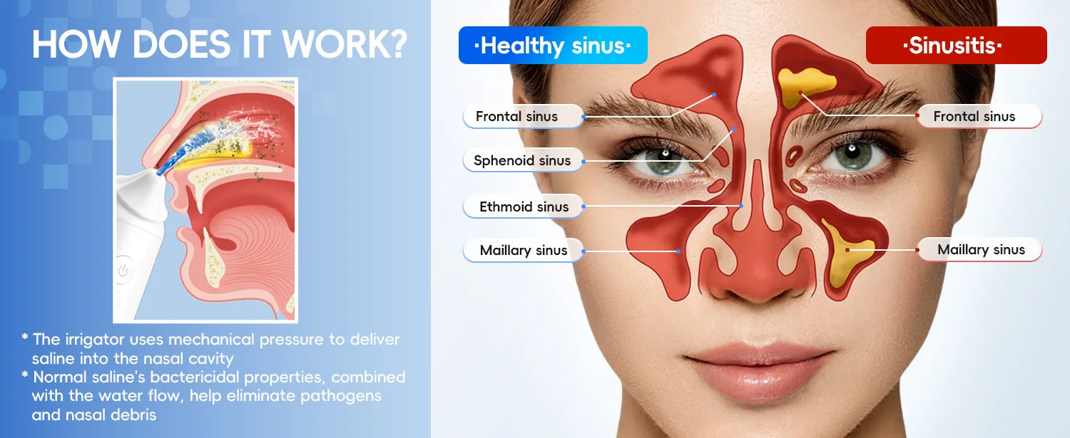 Electric Nasal Irrigation System for Sinus Relief - 9