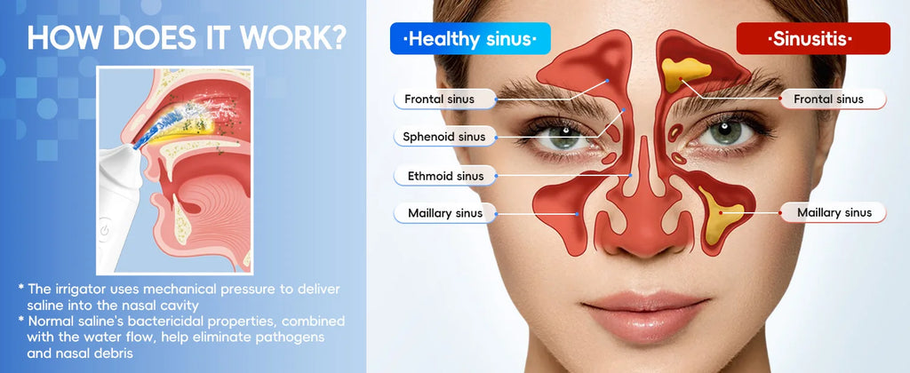 Electric Nasal Irrigation System for Sinus Relief