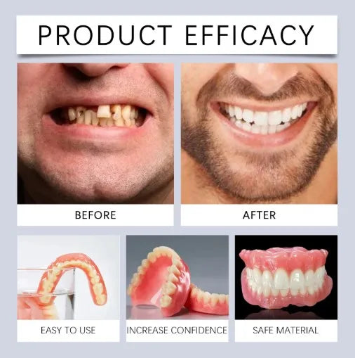 Realistic Silicone Cosmetic Teeth Veneers