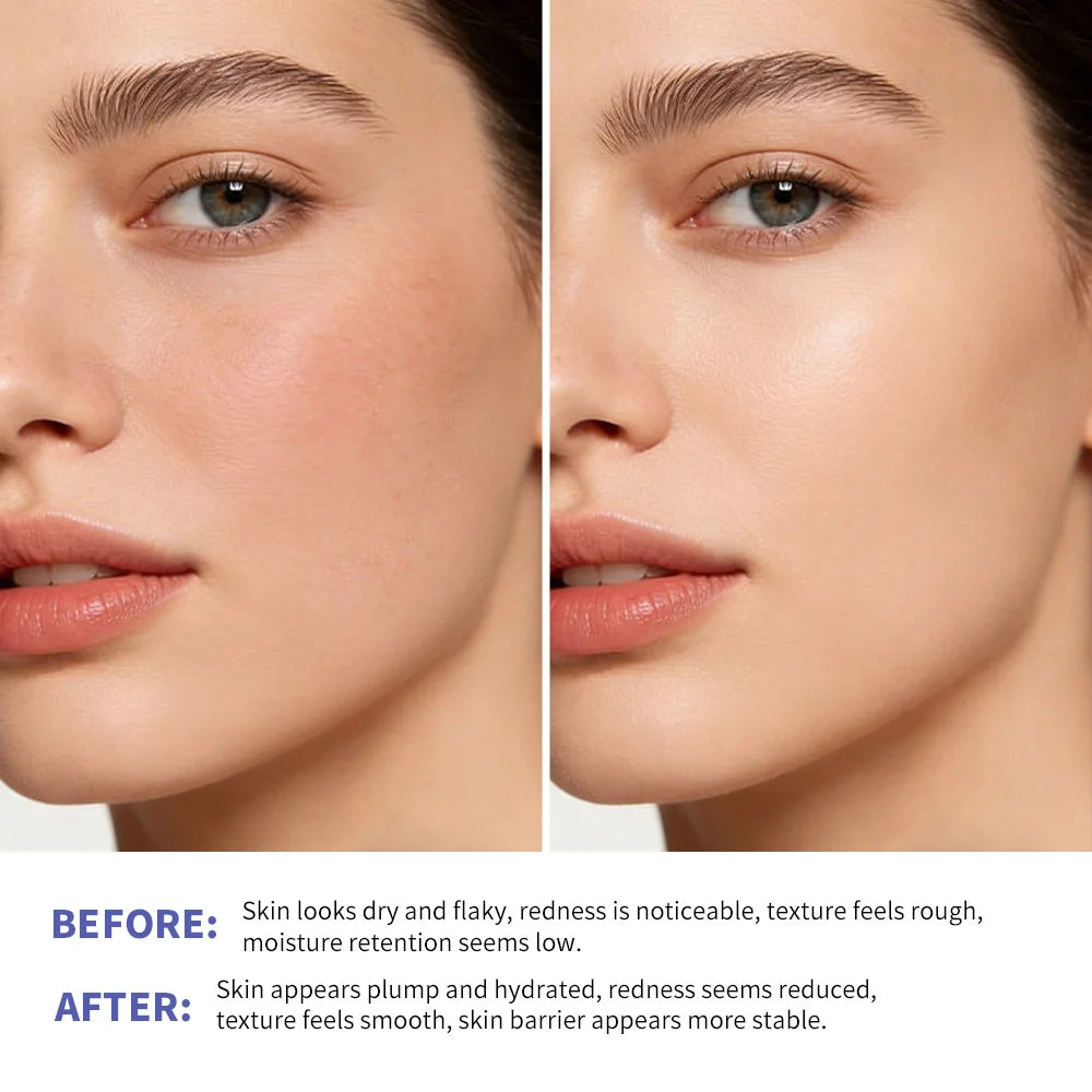 Triple Lipid Peptide Moisturizing Cream for Dry and Sensitive Skin
