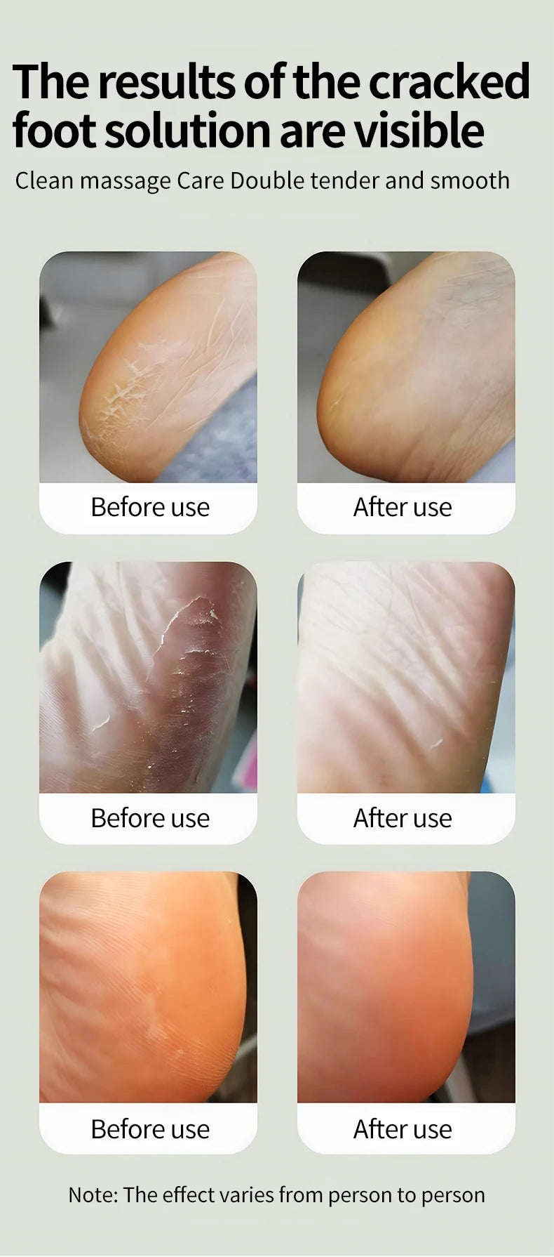 Electric Cordless Foot Callus Remover with 6 Speed Settings