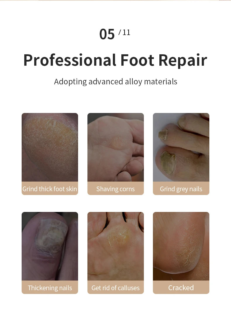 Electric Rechargeable Foot Callus Remover for Pedicure - 13