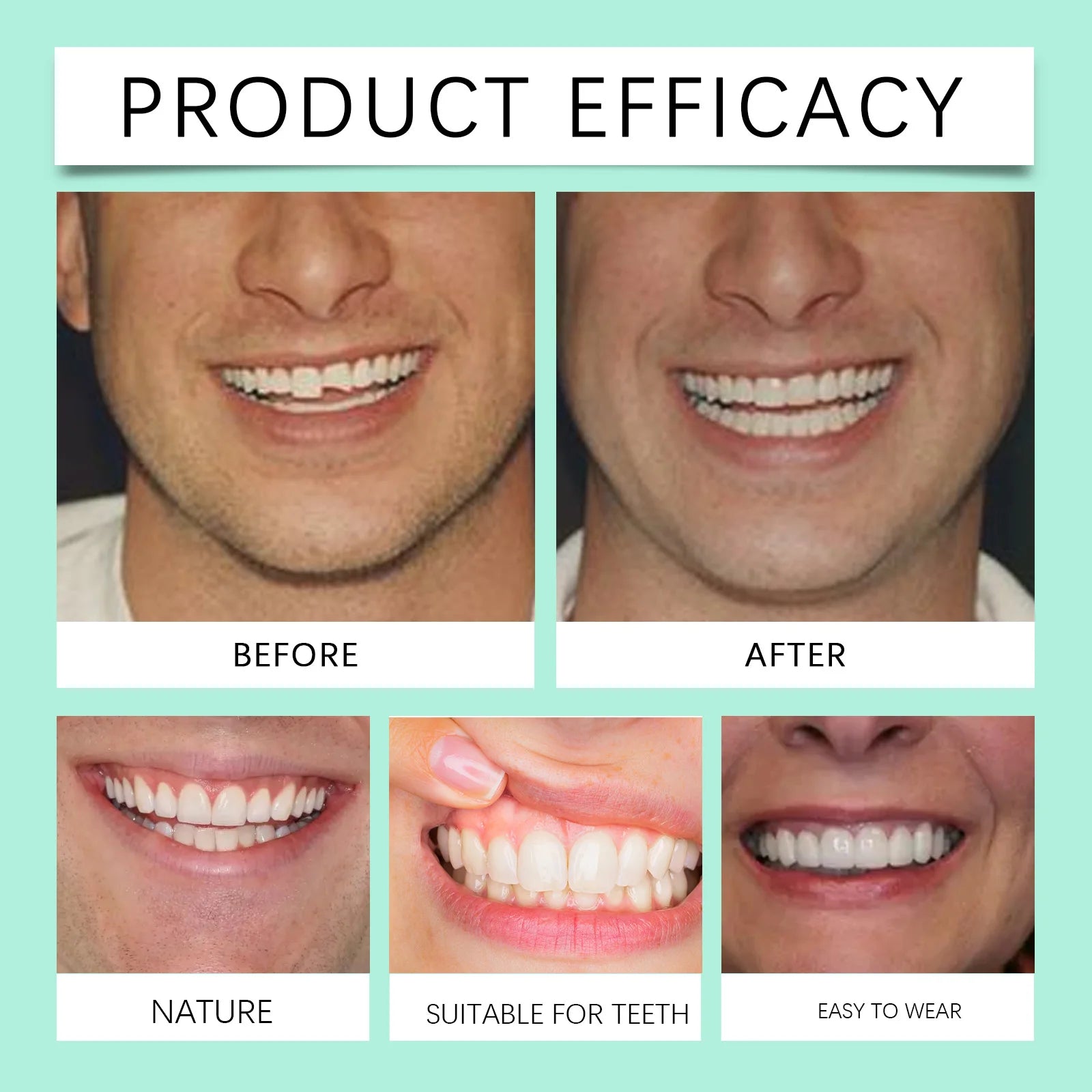 Flexible Silicone Denture Set for Instant Smile Transformation - 12