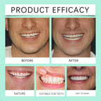 Flexible Silicone Denture Set for Instant Smile Transformation