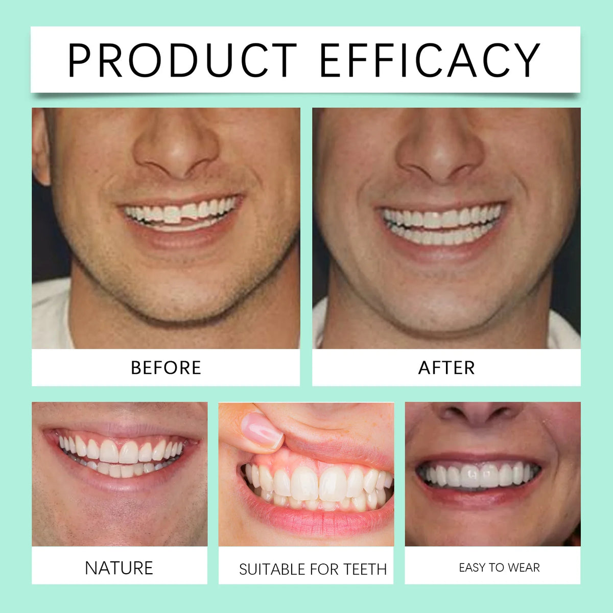 Flexible Silicone Denture Set for Instant Smile Transformation