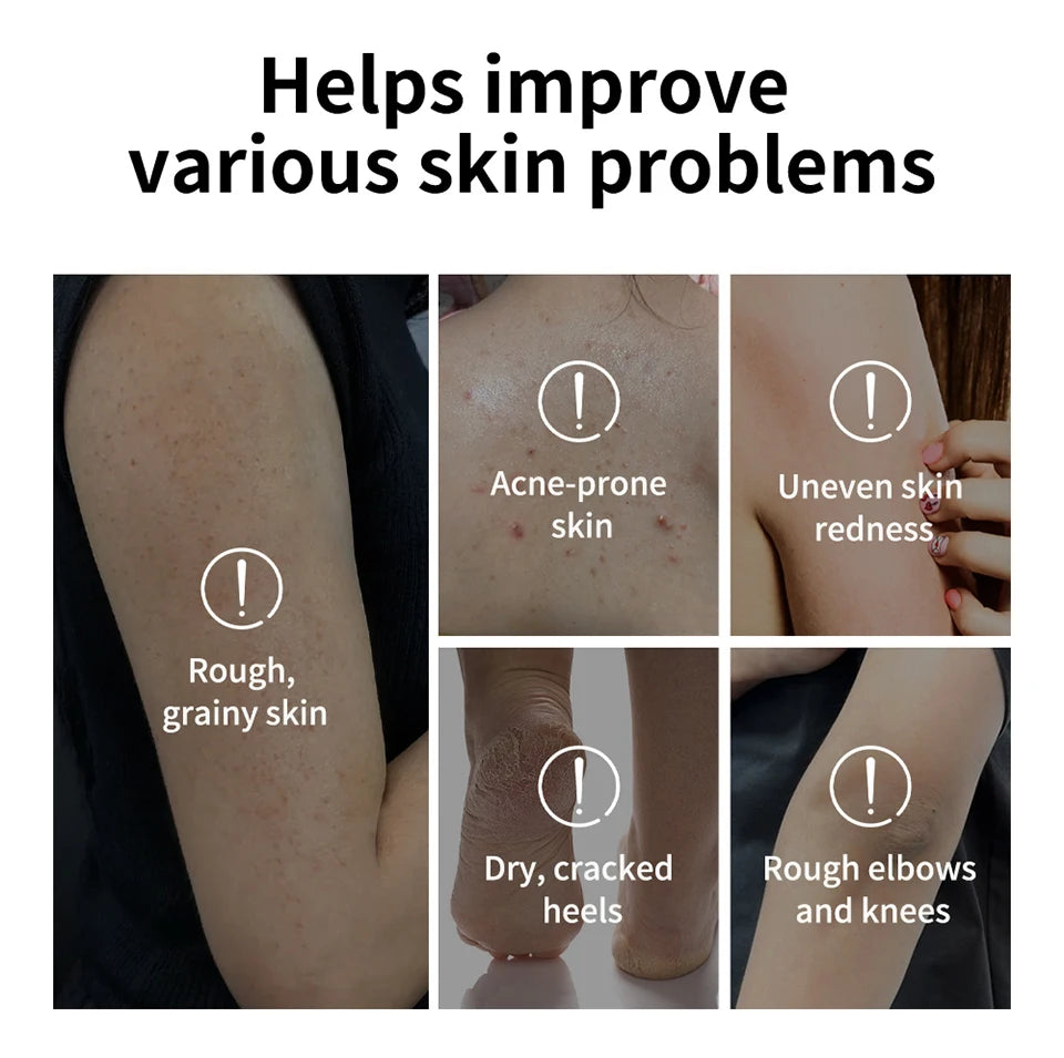 Glycolic Acid Exfoliating Body Stick for Smooth Skin - 11