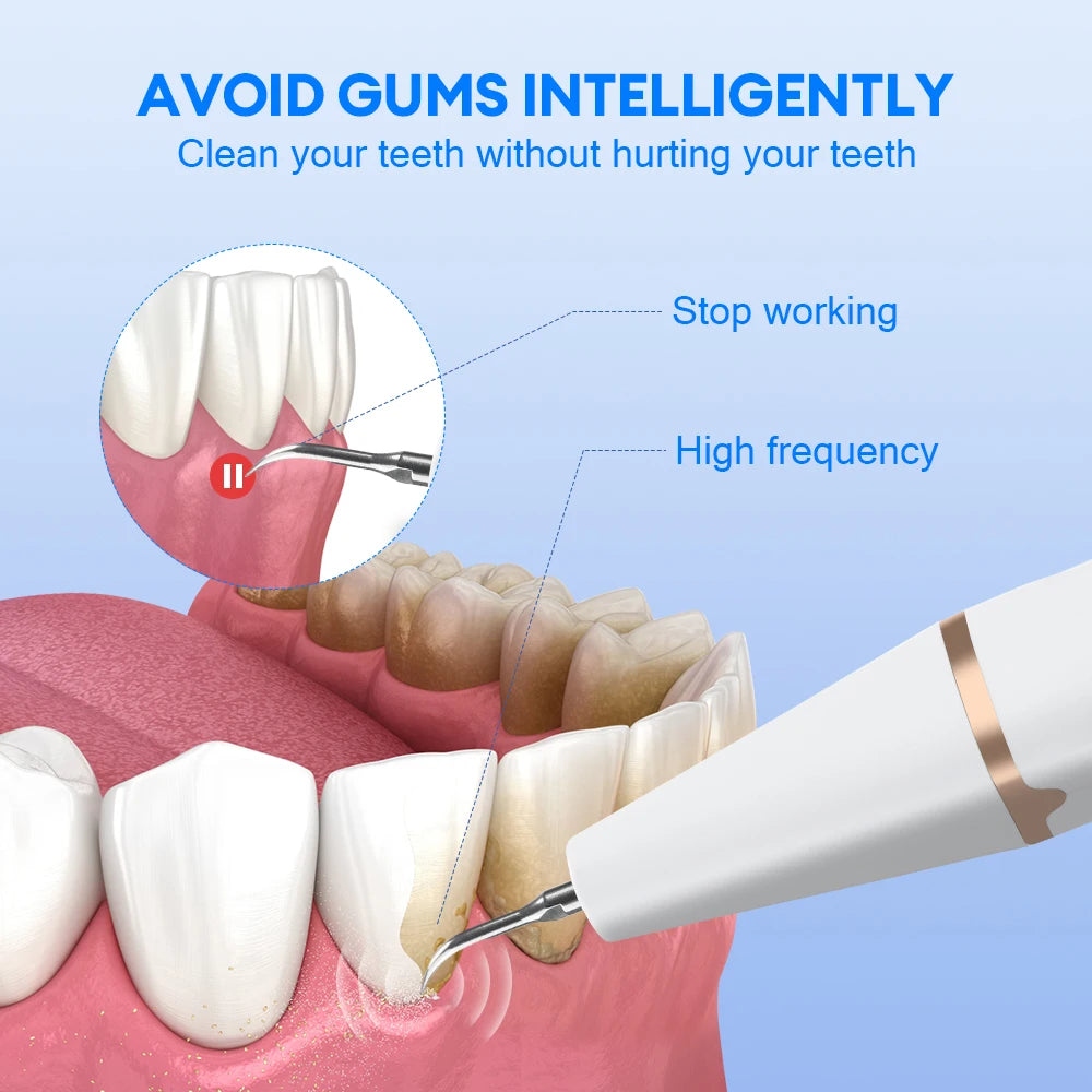 Ultrasonic Electric Teeth Tartar and Plaque Remover - 3