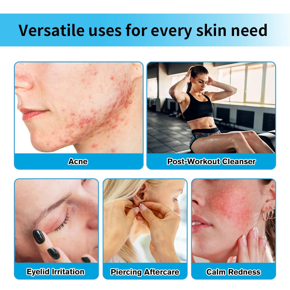 Hypochlorous Acid Facial Spray for Acne and Skin Redness - 3