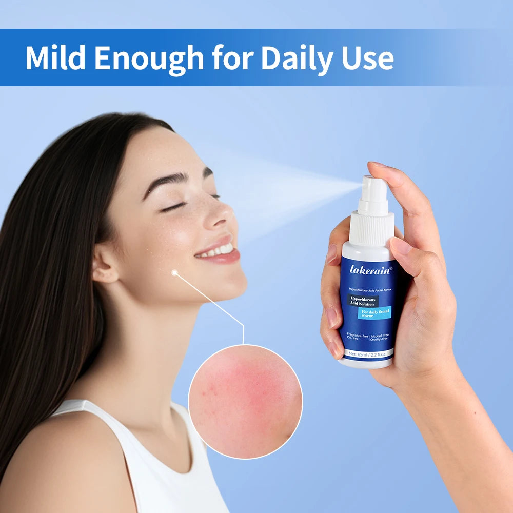 Hypochlorous Acid Facial Spray for Acne and Skin Soothing - 1